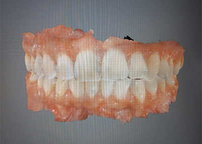 EscanerIntraoral-21